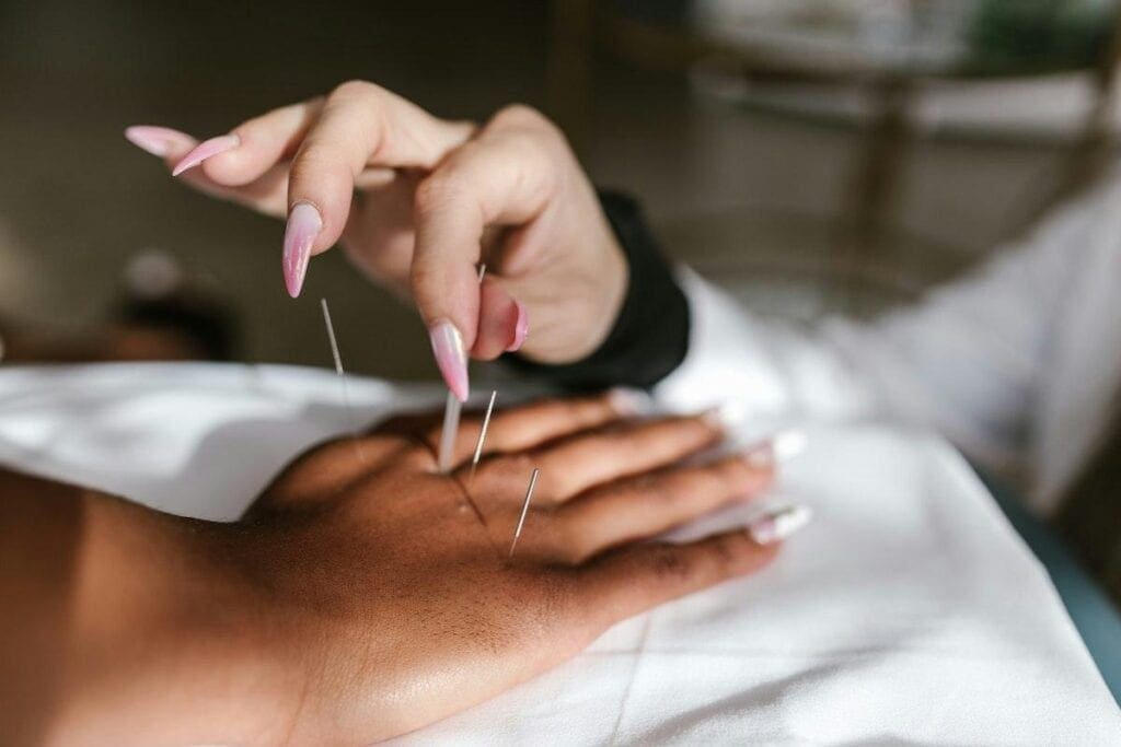 Dry Needling For Tendonitis Pain Relief