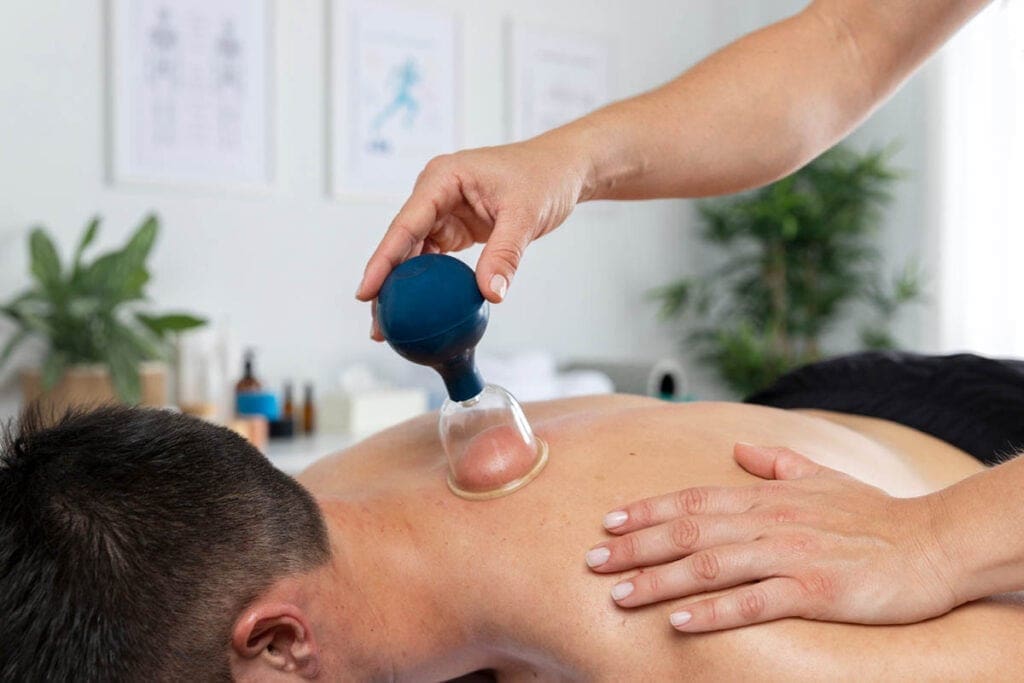 Does Cupping Work Exploring Cupping for Back Pain Relief