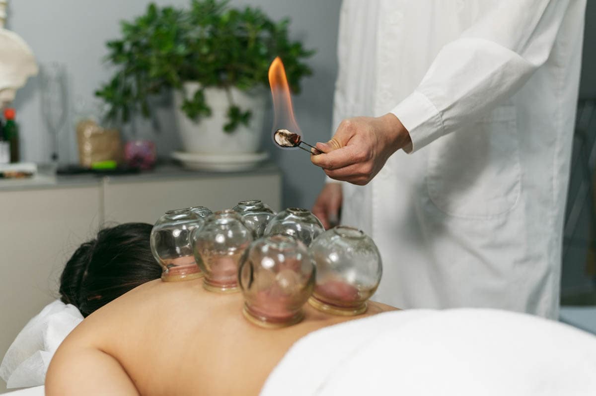 Benefits of Cupping for Back Pain Relief